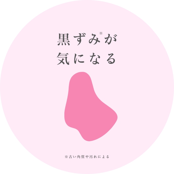 黒ずみが気になる