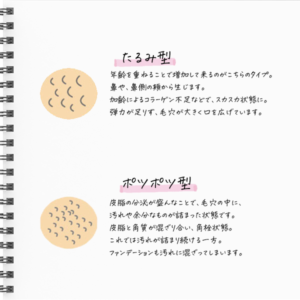 毛穴タイプ